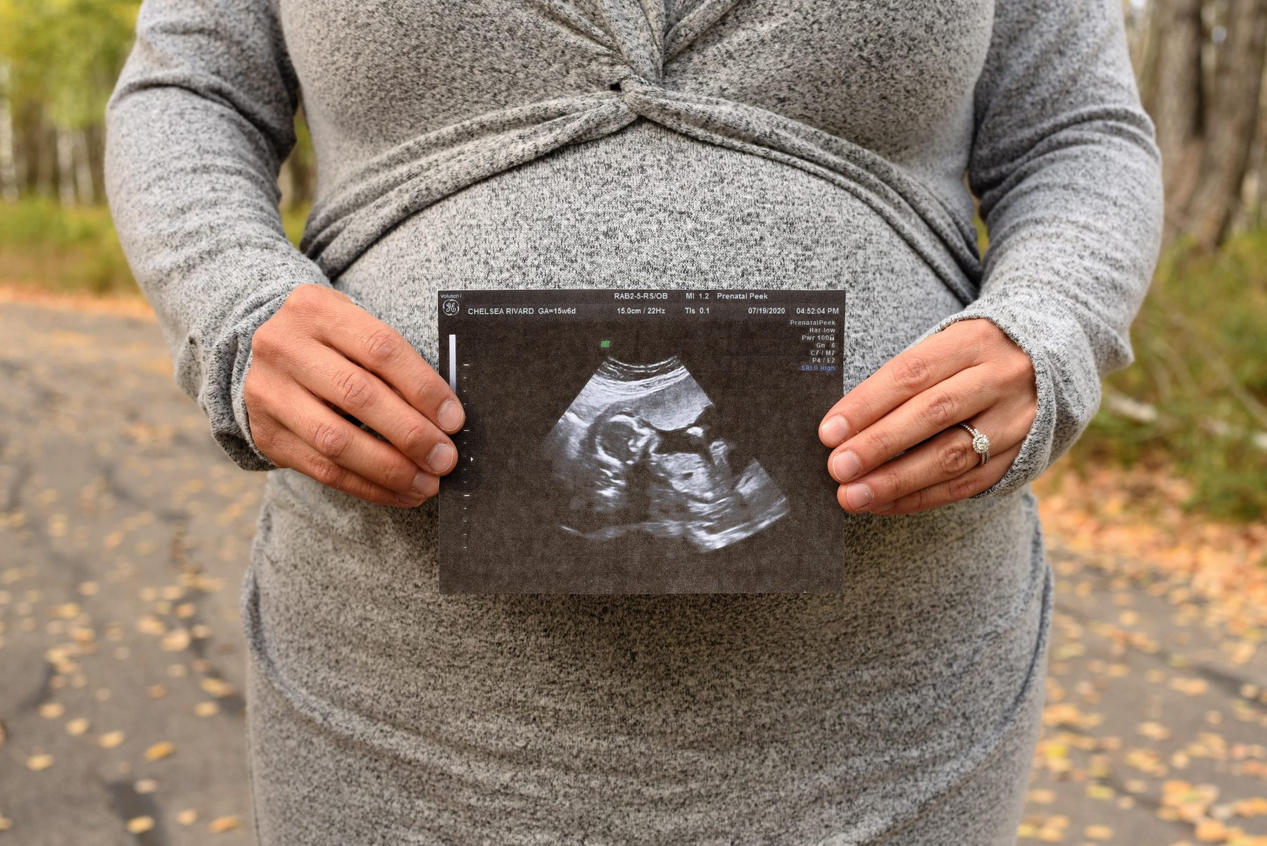Maternity photography in Winnipeg — photograph by TAG Photography
